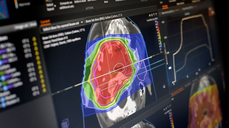 Raysearch: Insidersälj och vinstvarning skickar aktien till frysboxen - Raysearc