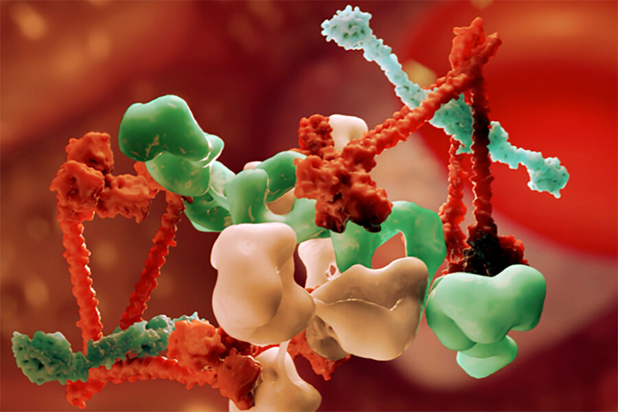 Calliditas-konkurrent misslyckades i fas 3 - IGA_NEPHROPATHY