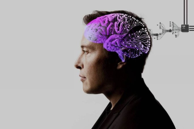 Musks Neuralink har opererat in det första hjärnimplantatet på människa - Neuralink