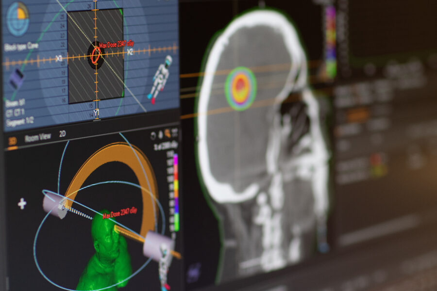 Raysearch får en första order på Druglog - RayStation_8B-Stereotactic-01